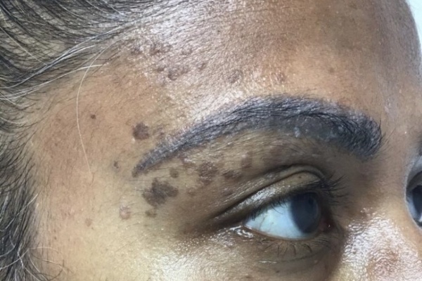 Dermatology-Led Aesthetic Clinic in London