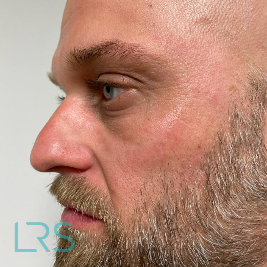 Dermatology-Led Aesthetic Clinic in London