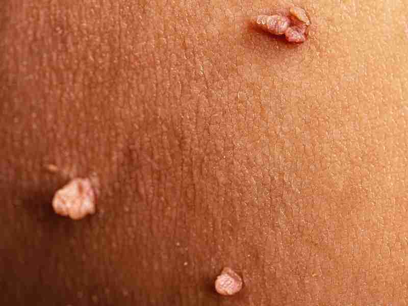 Dermatology-Led Aesthetic Clinic in London