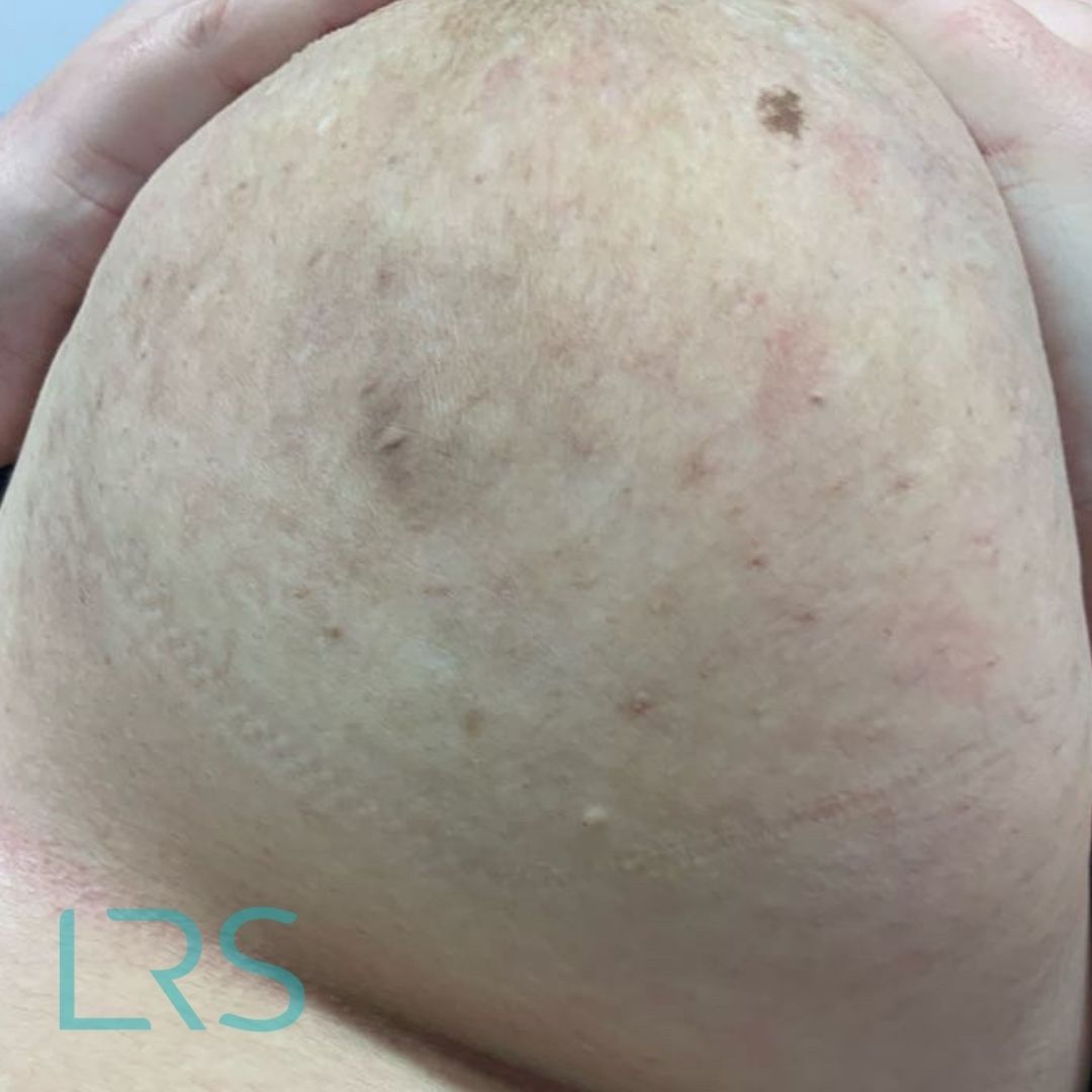 Dermatology-Led Aesthetic Clinic in London