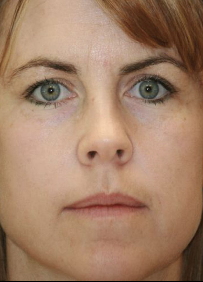 Dermatology-Led Aesthetic Clinic in London