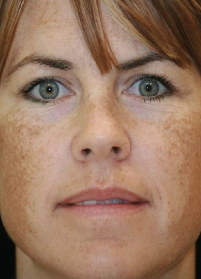 Dermatology-Led Aesthetic Clinic in London