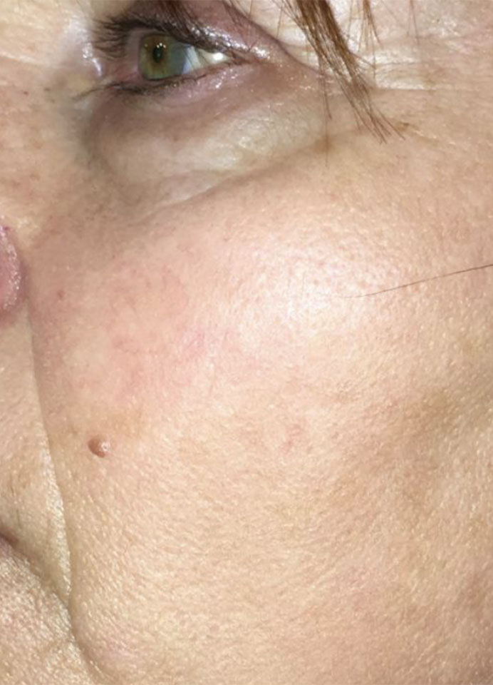 Dermatology-Led Aesthetic Clinic in London