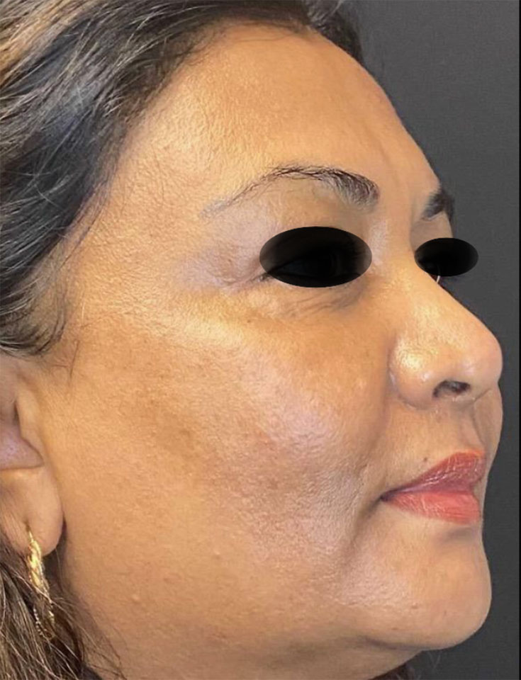 Dermatology-Led Aesthetic Clinic in London