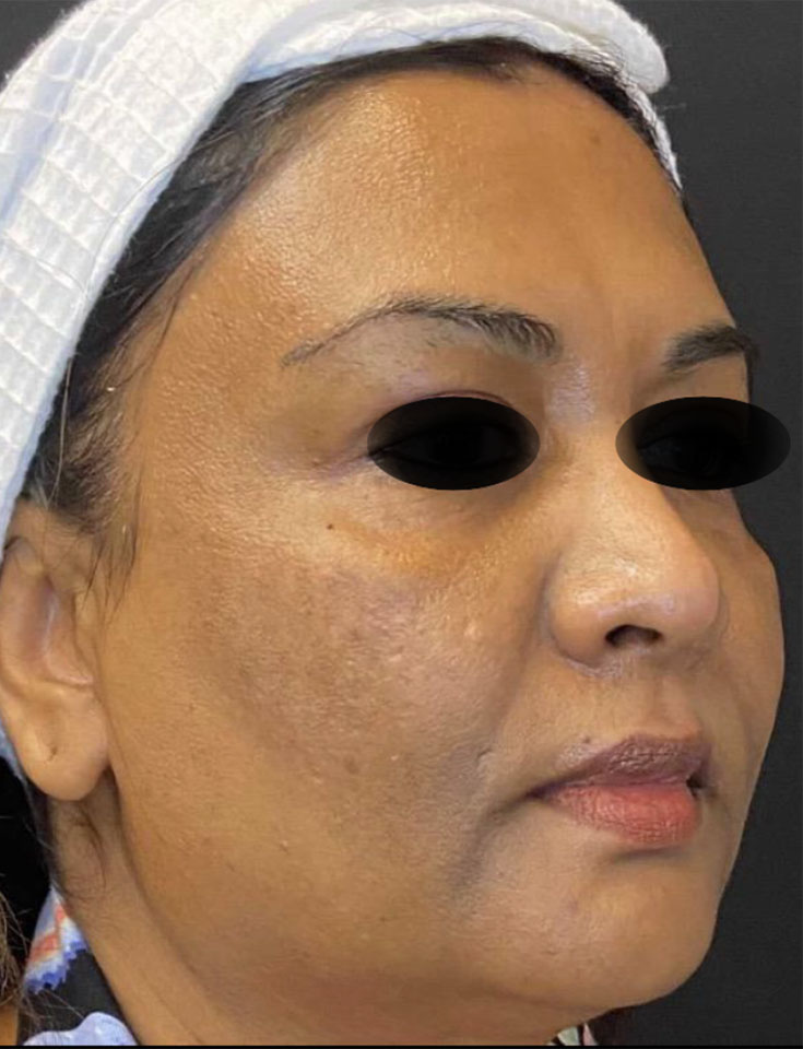 Dermatology-Led Aesthetic Clinic in London