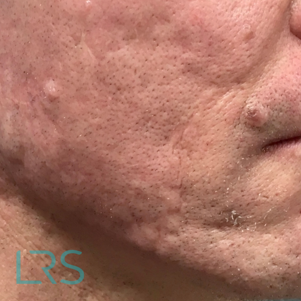 Dermatology-Led Aesthetic Clinic in London