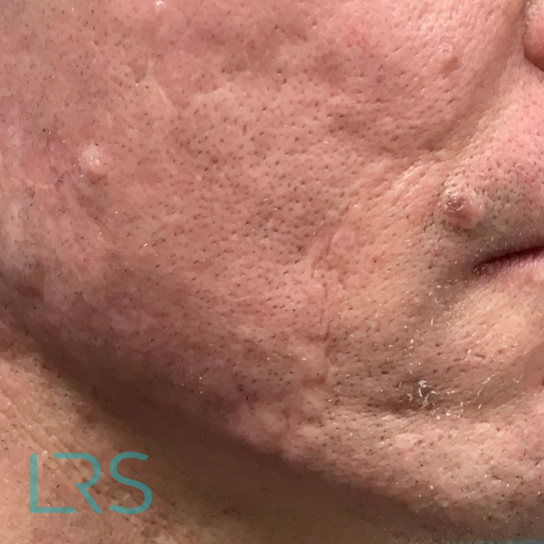 Dermatology-Led Aesthetic Clinic in London