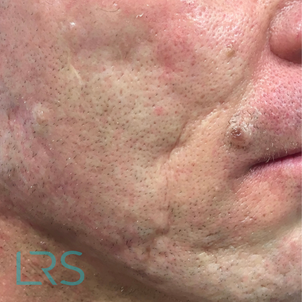 Dermatology-Led Aesthetic Clinic in London