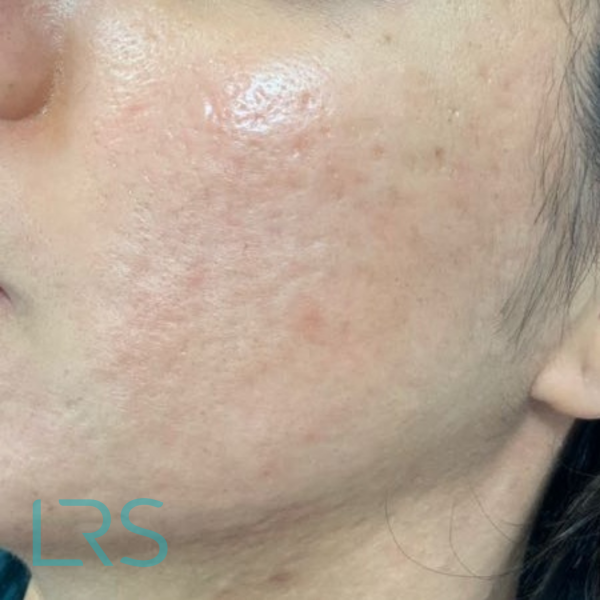 Dermatology-Led Aesthetic Clinic in London