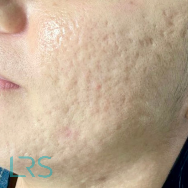 Dermatology-Led Aesthetic Clinic in London