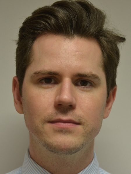 Male Jaw Enhancement - After 43