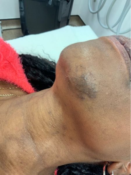 hair removal b4 68